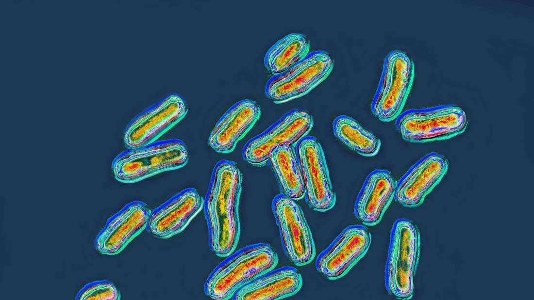 Image microscopique de salmonelles, liées à une intoxication alimentaire à l'hôtel.