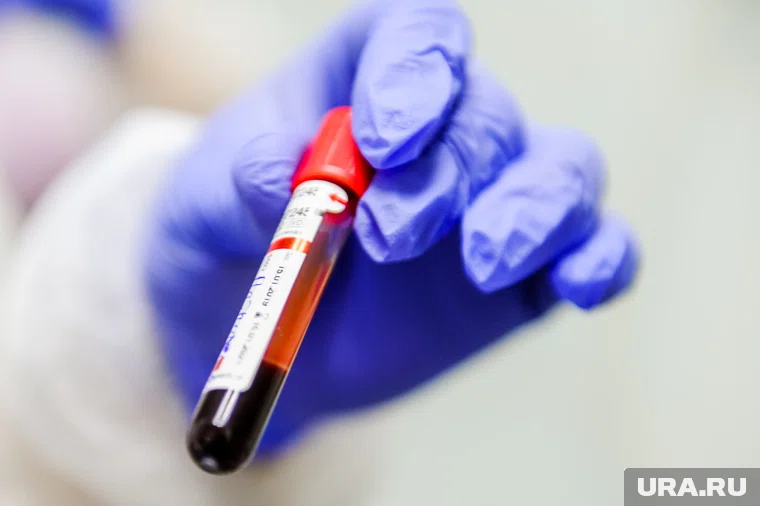 Découverte de biomarqueurs sanguins