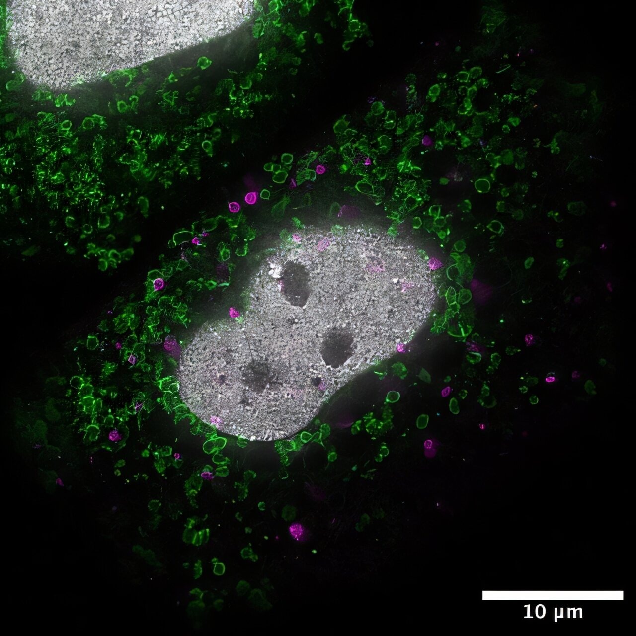 Image d'une cellule HeLa sous microscopie à super-résolution