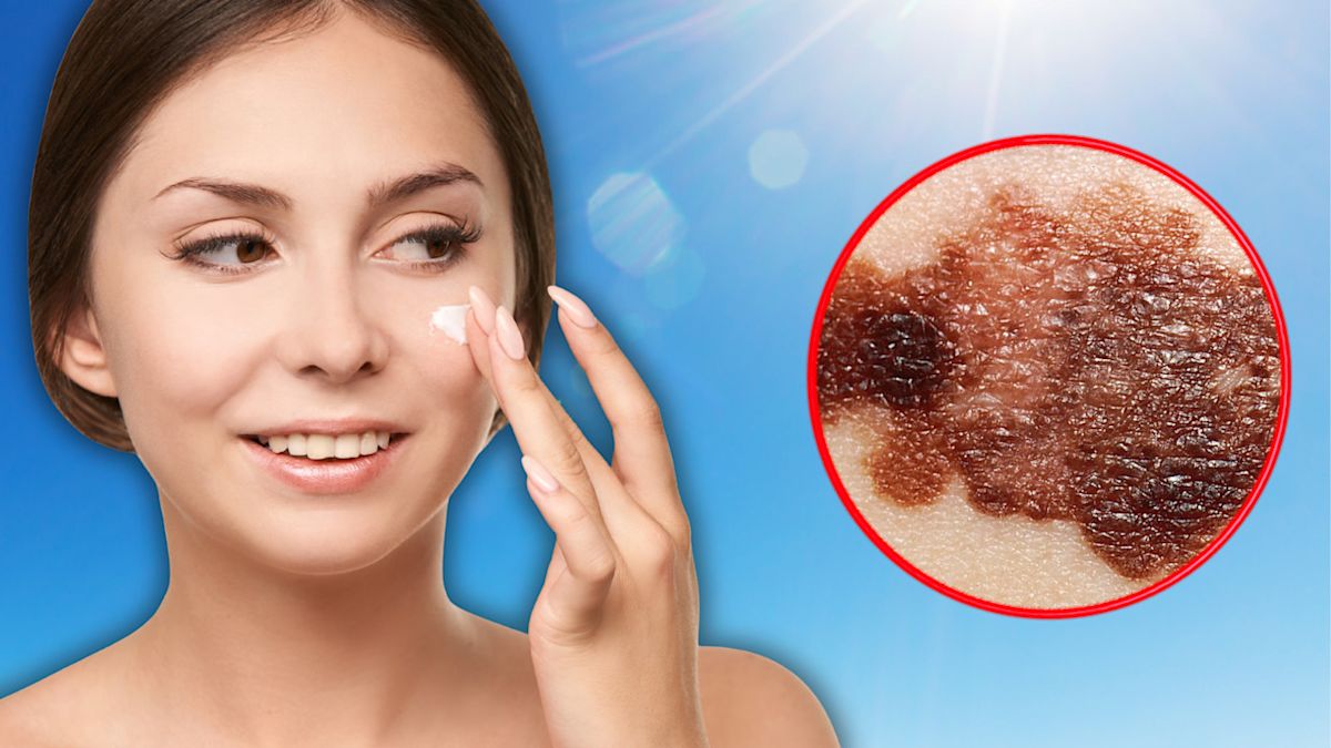 Une nouvelle tendance sur TikTok expose à un risque accru de cancer, avertissent les dermatologues !