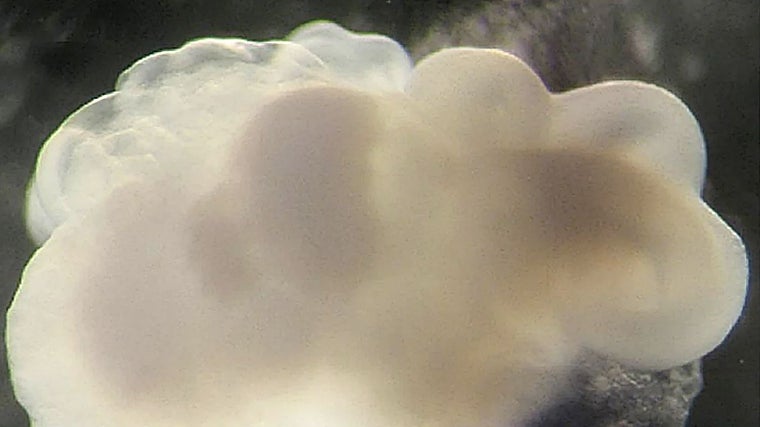 Organoïde cérébral cultivé à partir de cellules de peau humaine