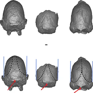 Fossile Little Foot, possible ancêtre humain, scans CT.